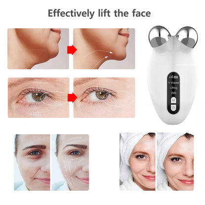 GlowFirm Facial Roller: EMS Microcurrent Anti-Wrinkle & Double Chin Remover